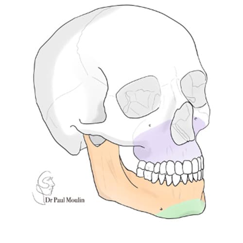 chirurgie orthognatique paris dr paul moulin chirurgien maxillo facial paris chirurgie orthognatique paris dr paul moulin chirurgien maxillo facial paris